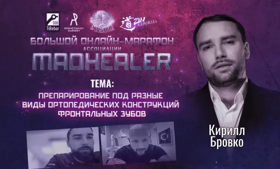 Препарирование под разные виды ортопедических конструкций фронтальных зубов.
