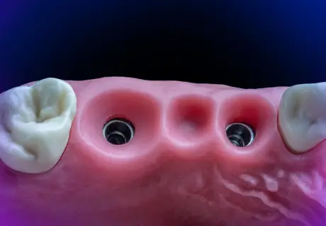 Стоматологический фантом M1-Prosthetic