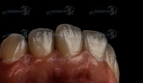 Оптика режущего края 11