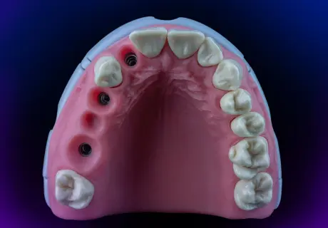 Стоматологический фантом M1-Prosthetic