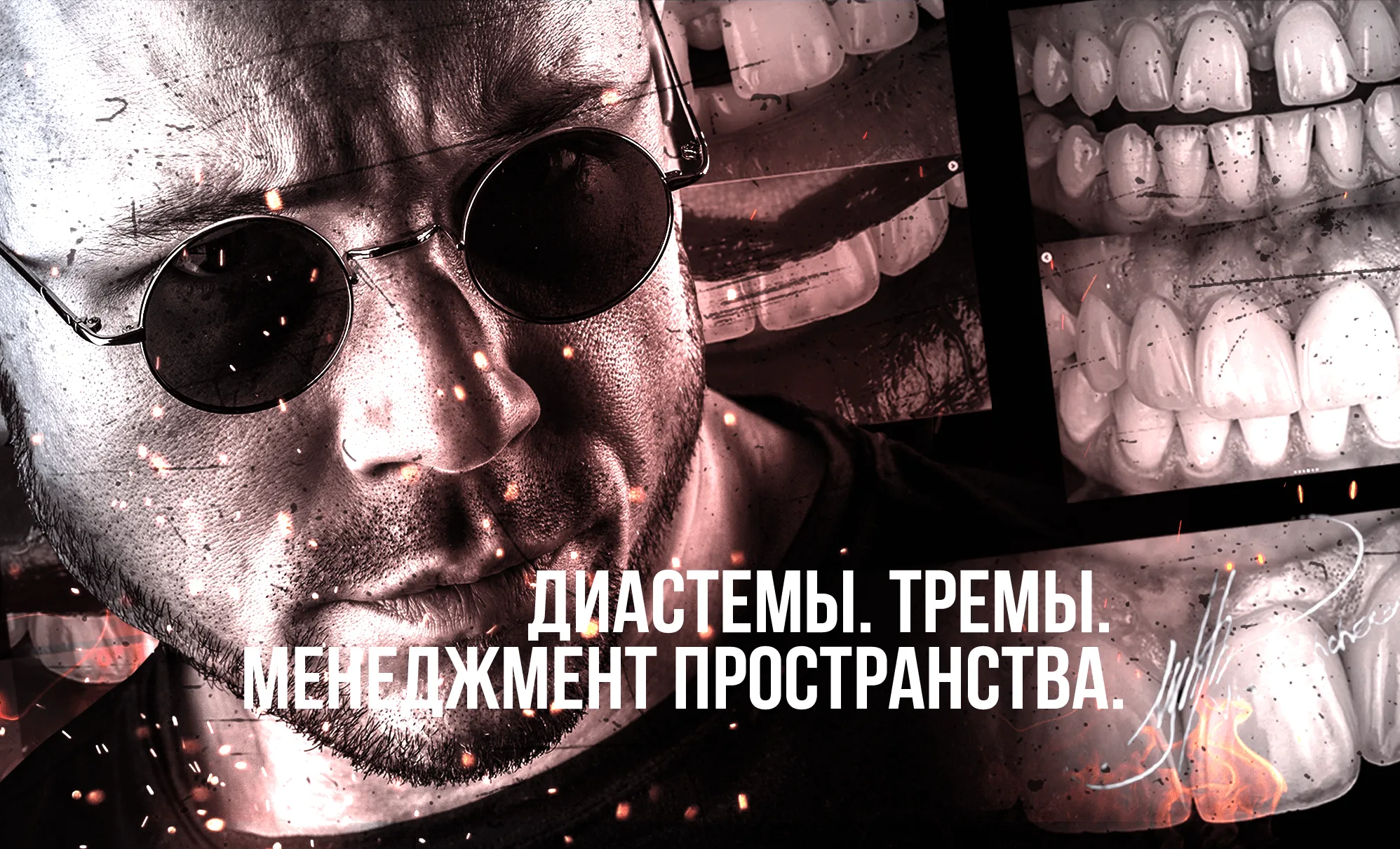 Диастемы. Тремы. Менеджмент пространства.
