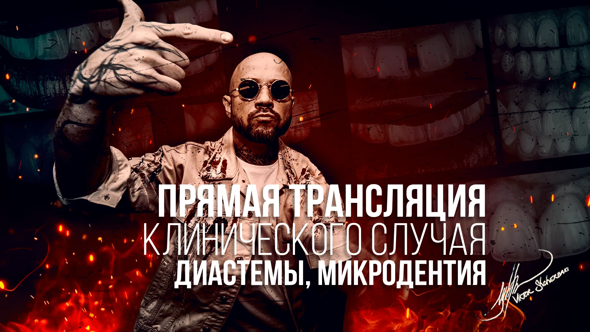 Живой клинический случай: Закрытие множественных диастем.